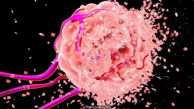 一些靶向的药物可以更有针对性的分解癌细胞。(图片来源: Alfred Pasieka/SPL)