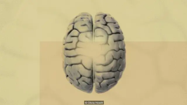 Beyinleri hasara uğramış hastaların en büyük şikayetlerinden biri de aşırı yorgunluk hissidir.