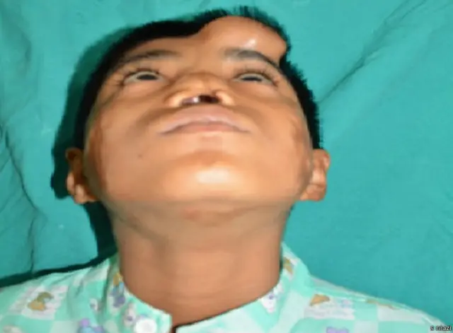 ارن کا آپریشن مکمل کرنے میں ایک سال لگ گیا