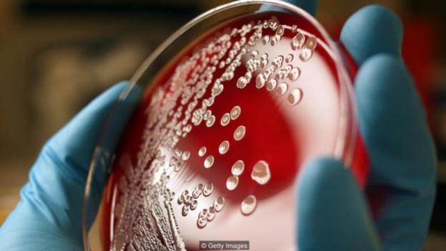 每个指尖上可发现数以千万计的细菌。(图片来源: Getty Images)