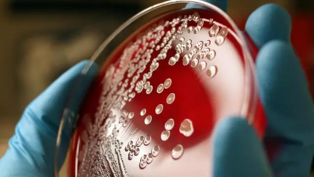 قد تؤوي المنطقة ما بين الأنامل والأظافر مئات الألاف من أنواع البكتيريا