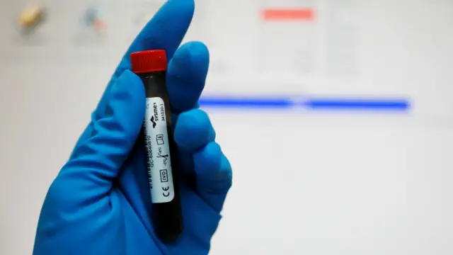 一名技术人员手持着血液样本