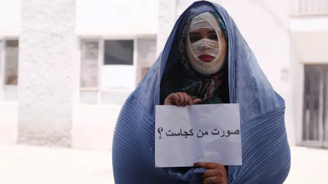 اعتراض یک خواننده رپ افغانستان به اسیدپاشی اخیر