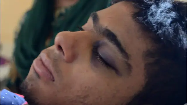 ڈیڑھ ہزار سے زائد افراد زخمی ہوئے ہیں