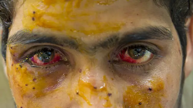 श्रीनगर के एक अस्पताल में भर्ती मोहम्मद इमरान पैरी.