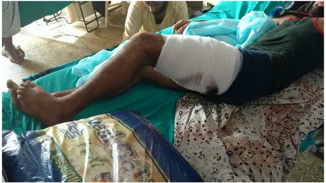 کولگام کے ایک زخمی نوجوان کہتے ہیں: ’میں تو برہان کے جنازے میں گیا تھا۔ میں نے کبھی پتھر نہیں اُٹھایا، آپ ہی بتائیں اب میں کیا کروں؟ کیا میں اس ظلم پر خاموش بیٹھوں؟‘