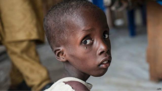 ربع مليون طفل يعانون سوء التغذية بسبب بوكو حرام في نيجيريا BBC  
