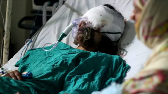 انشا مشتاق کا چہرہ سوجنے کے بعد مکمل طور پر بگڑ گیا ہے اور ڈاکٹروں کا کہنا ہے کہ ان کی حالت نازک ہے