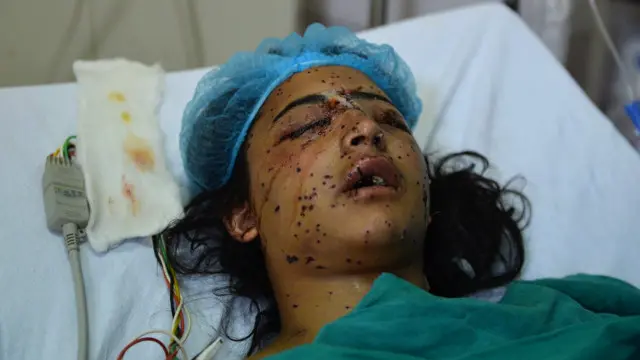 पेलेट गन