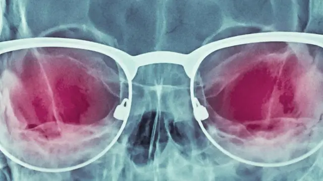 एक्स-रे चश्मे