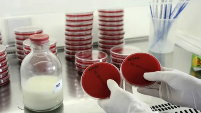 آزمایش شیر مادر از نظر آلودگی میکروبی در بانک شیر