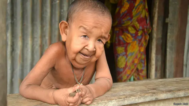 বায়জিদ শিকদার: চার বছরেই দেখায় বৃদ্ধ মানুষের মতো