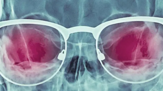 （图片来源：科学图片库）