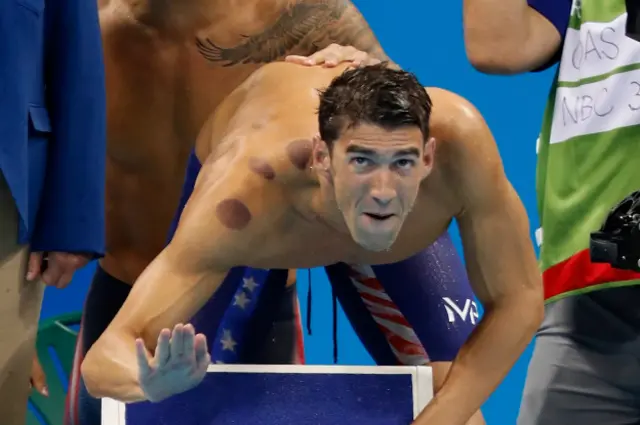 Що це за загадкові кружечки на плечах у Майкла Фелпса?