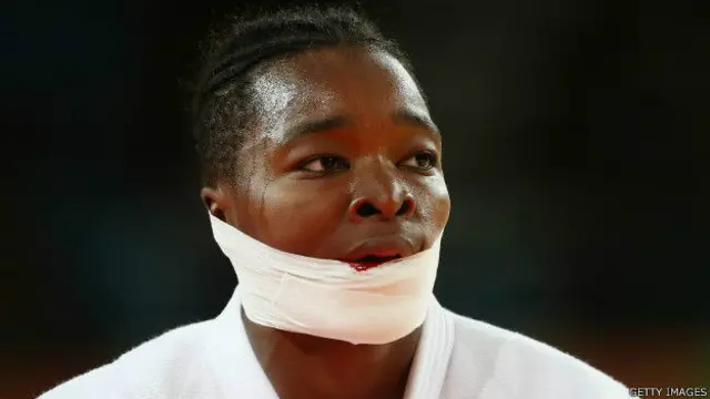 د فرانسې د جوډو لوبغاړی خپل بريتانوي سيال څخه له ماتې خوړلو وروسته