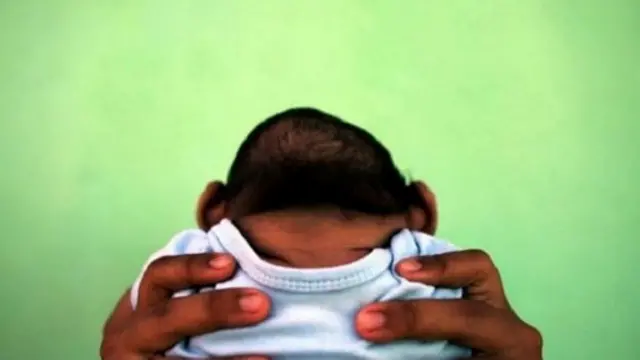 最大的危險是妊娠時感染寨卡病毒，因為病毒會侵害胎兒