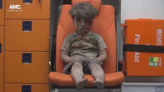 دا هلک چې عمران نومېږي د سوریې د جګړې پر یوه سمبول واوښت