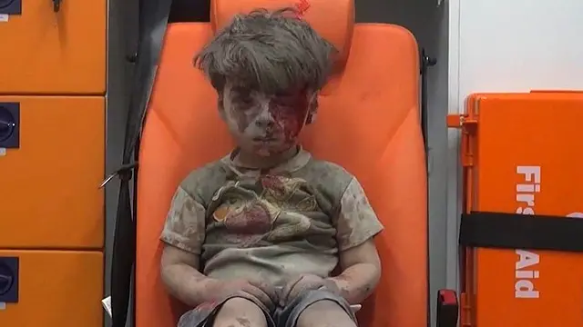 لفتت صورة عمران أنظار العالم إلى المأساة التي يعيشها سكان حلب