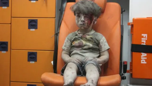  Omran Daqneesh nhìn thẫn thờ và bê bết máu ở phía sau một xe cứu thương sau một cuộc không kích ở Aleppo