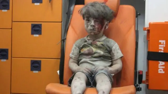 الطفل السوري عمران داقنيش ظهر في سيارة الإسعاف بوجهه المخضب بالدماء والغبار وكأنه تمثال يحدق للأمام بعيون مرهقة