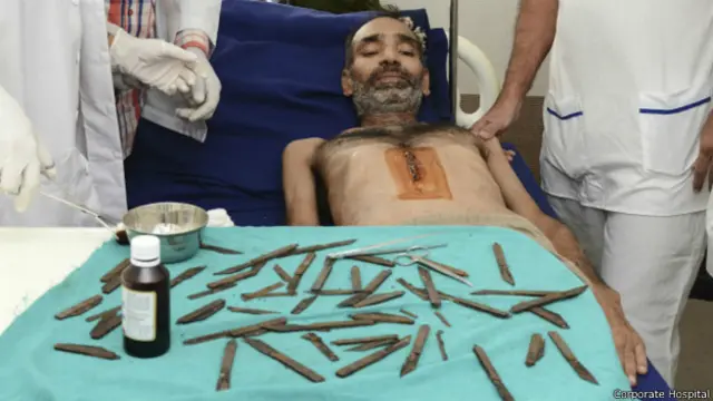 ډاکټرانو ویلي، تر هغو ناروغ ته له روغتون نه د وتلو اجازه نه ورکوي، چې پوره ښه شوی نه وي.