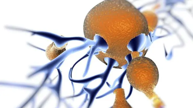 لا يزال الارتباط بين جسيمات التلوث ومرض الزهايمر قيد الدراسة.