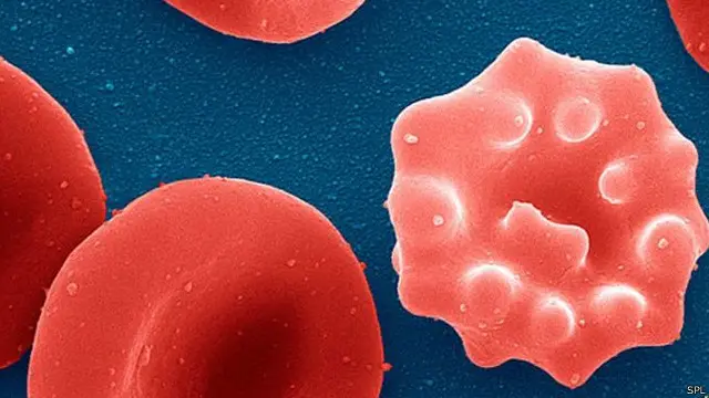 ایک اندازے کے مطابق دنیا کی نصف آبادی کو ملیریا ہونے کا خدشہ ہے