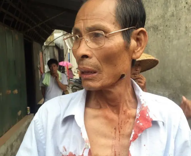 一名疑似受伤村民(乌坎村村民提供照片13/9/2016)