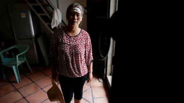 一名头部受伤的乌坎村女村民（14/9/2016）