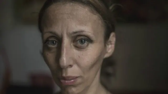 "أيا أوكأوري" تبلغ من العمر 42 عاما وهي أم لطفلين، وتعيش مع زوجها وشقيقه، ويعملان في أعمال غير منتظمة لكسب قوتهم.