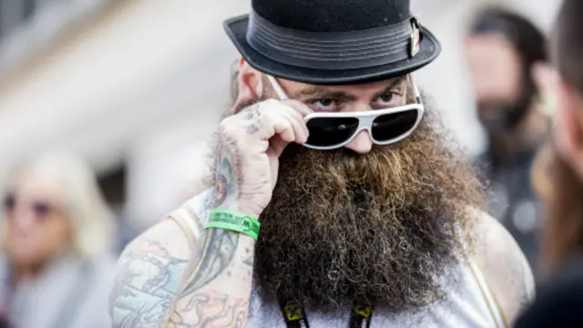 一些人的毛髮較為茂盛（圖片來源：Getty Images）