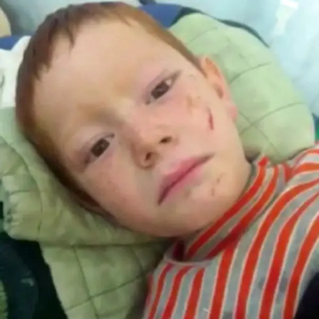 这个小男孩脊椎受伤