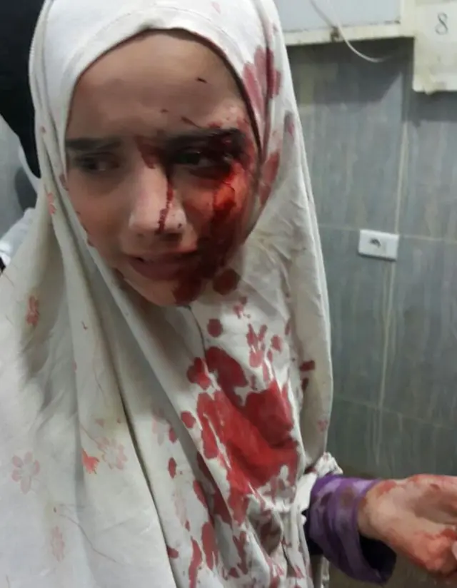 阿勒颇东部，这个女孩子在等待接受治疗