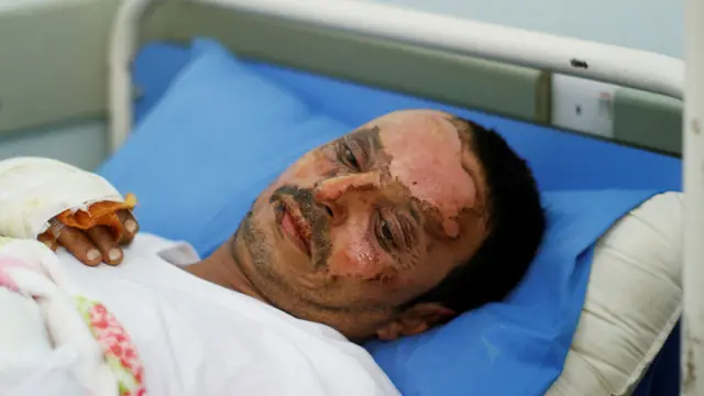 أصيب في الحادث أكثر من 500 شخص. 