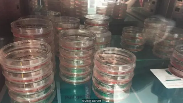  兰卡斯特的目标是把人的皮肤变成可以工作的脑细胞（图片来源：Zaria Gorvett）