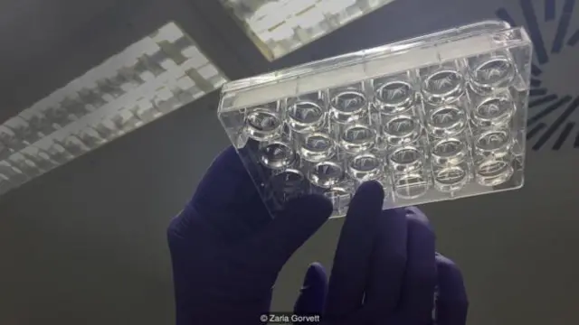 神经元互相发射信息，大脑正在快速运转（图片来源：Zaria Gorvett）