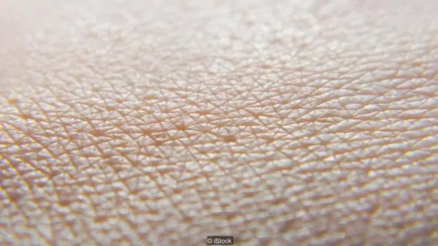 正常皮膚結構與瘢痕組織存在很大差異。 (圖片來源: iStock)