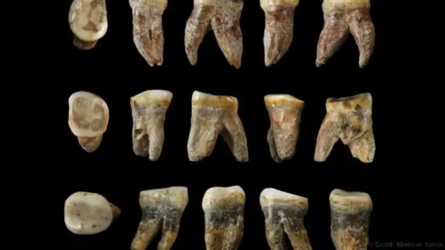 在前农业社会，龋齿非常罕见（图片来源：Martinon Torres）