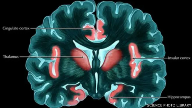 大腦的島葉與人的痛苦和恐懼等情感密切相關。