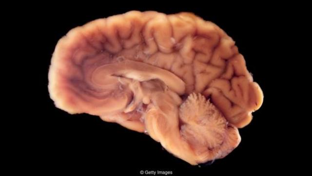 我们身体中25%的氧气要供给大脑，这意味着如果我们停止呼吸，第一个死亡的器官就是大脑。(图片来源: Getty Images)