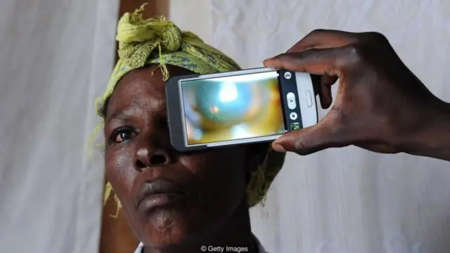 人工智能可能很快在医疗、病情诊断方面发挥不可替代的作用，比如通过医学影像诊断眼部疾病和癌症。（图片来源：Getty Images）