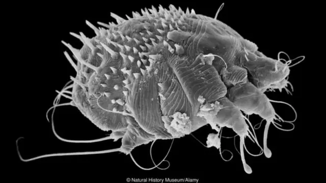 由疥螨引起的兽疥癣感染。（图片来源: Natural History Museum/Alamy）