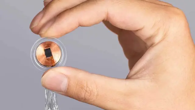 Neuralink'in beyne yerleştirilen ilk çipi N1