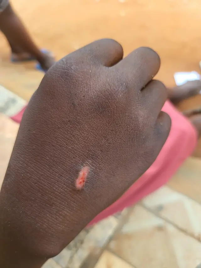 Hand of school pikin wey play Snake bite game 