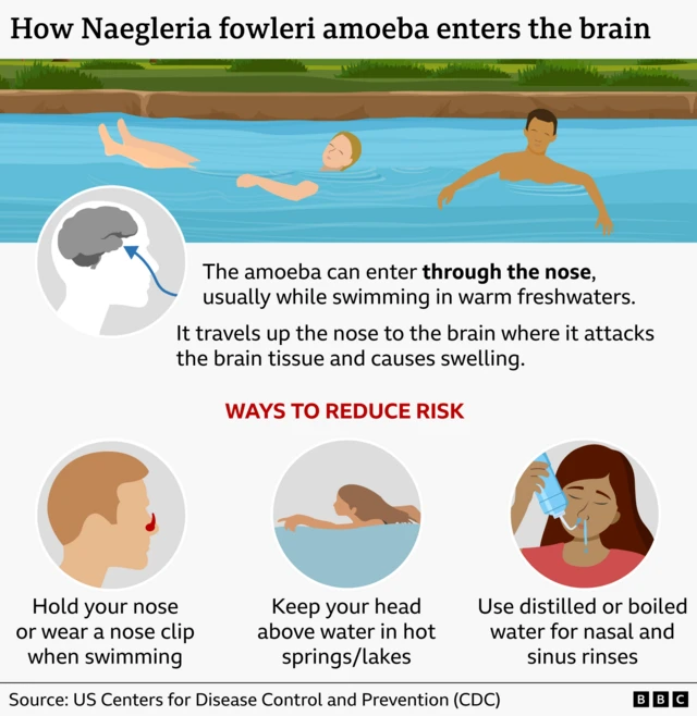 Visual journalism graphic shows How Naegleria fowleri enters the brain