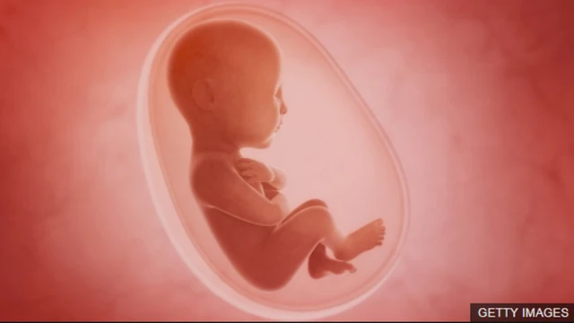 డిజైనర్ బేబీస్