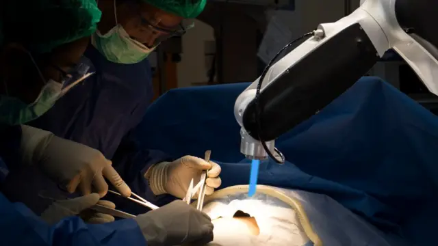 Robot en una cirugía.