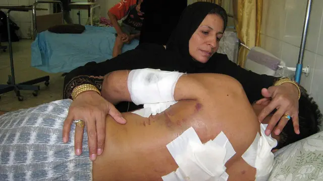 ব্ল্যাকওয়াটার নিরাপত্তা রক্ষীদের গুলিতে আহত হাসান জব্বার বাগদাদের হাসপাতালে চিকিৎসাধীন - ২২শে সেপ্টেম্বর ২০০৭