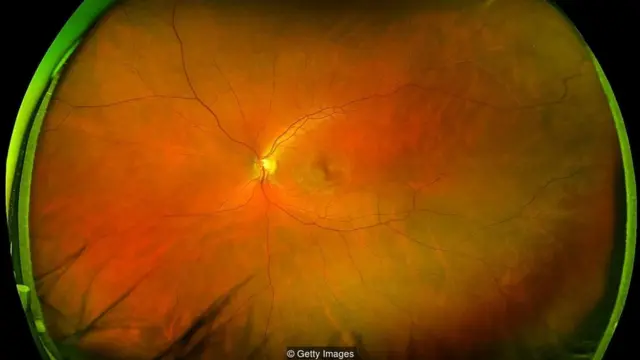 वर्चुअल डॉक्टर, आर्टिफ़िशियल इंटेलिजेंस