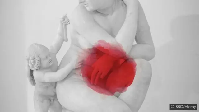 Certains médecins continuent de dire aux patientes que la grossesse est un traitement efficace